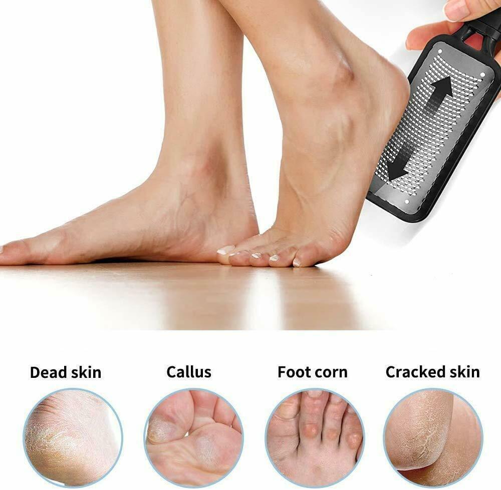 Callus Remover Pedicure Tool for Smooth, Soft Feet 8 Twokee.com