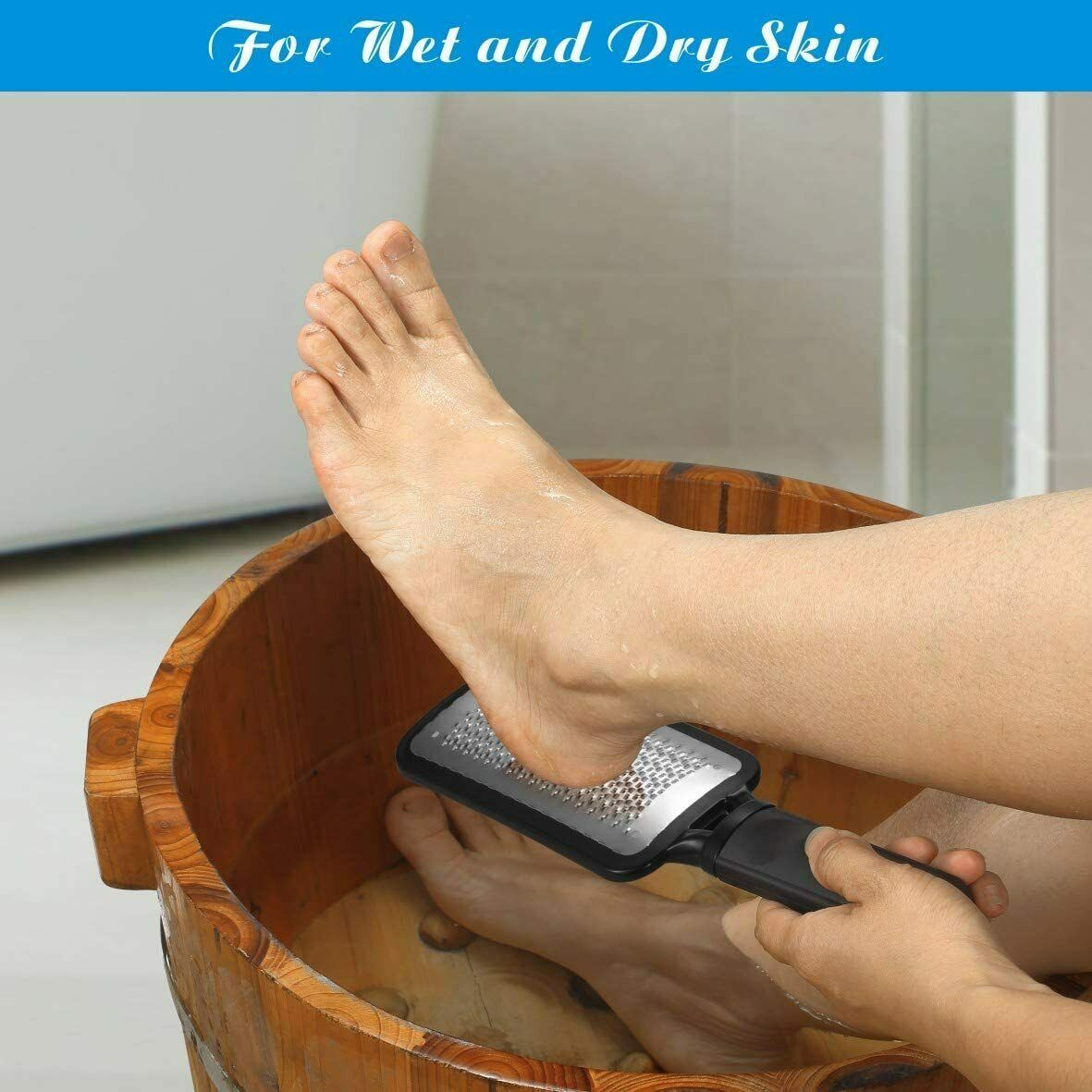 Callus Remover Pedicure Tool for Smooth, Soft Feet 7 Twokee.com