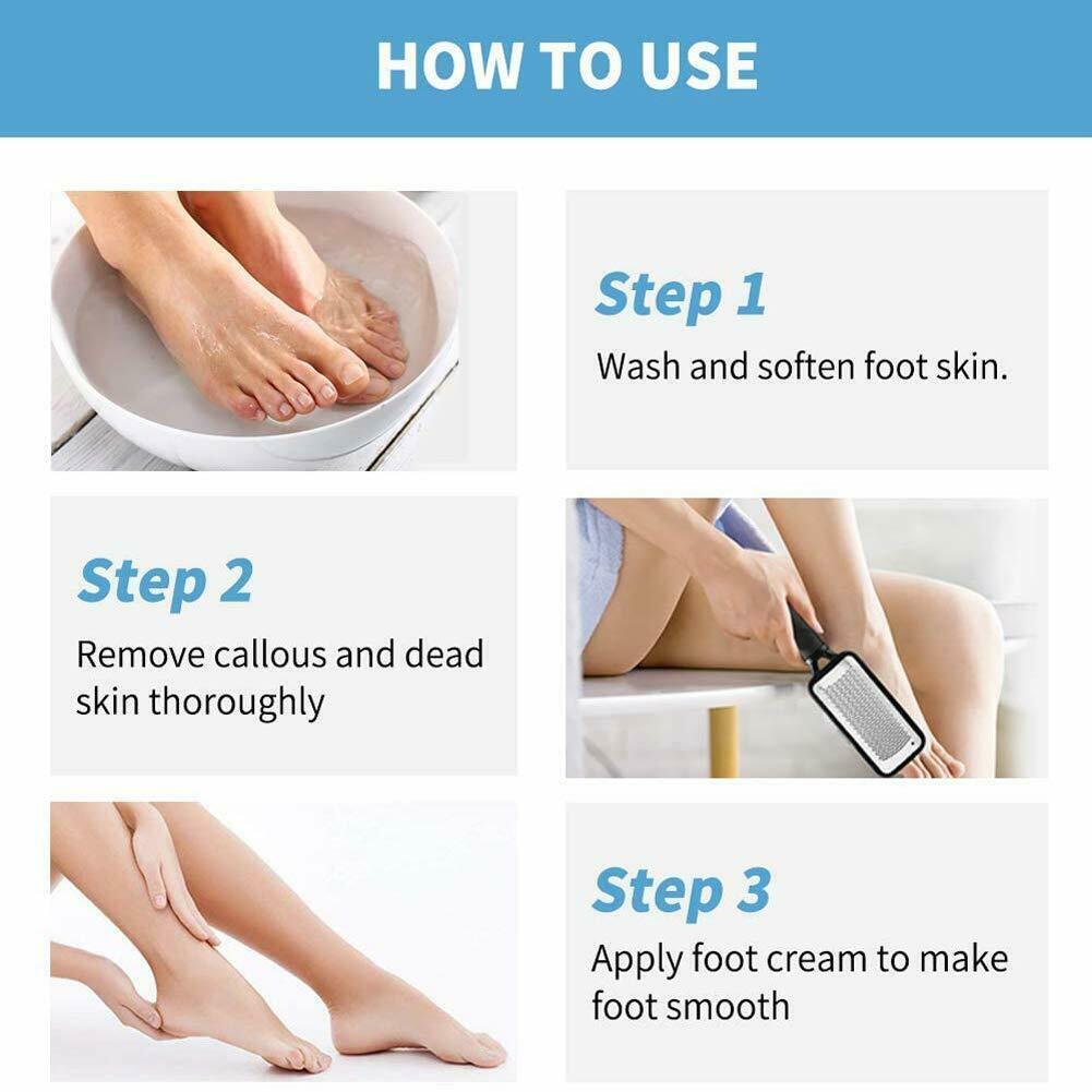 Callus Remover Pedicure Tool for Smooth, Soft Feet 10 Twokee.com
